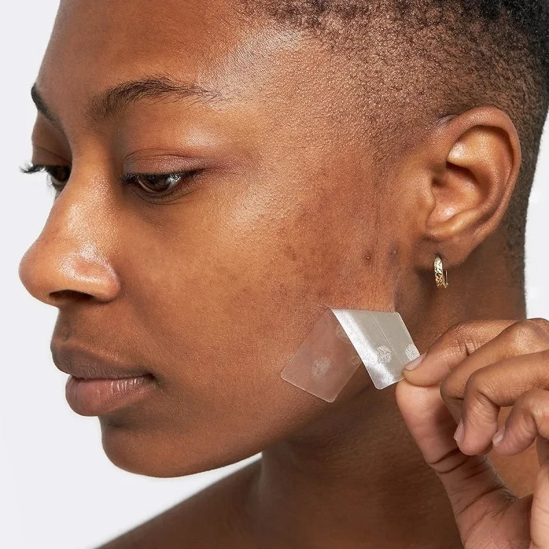 Hydrocolloid Acne Healing Patches